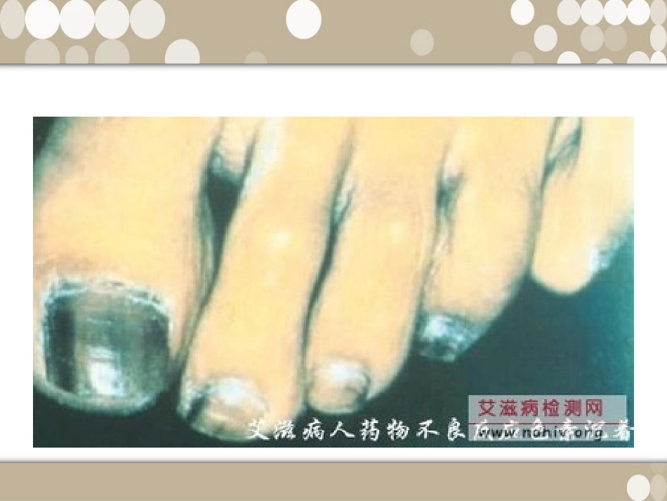 药物不良反应_第8页