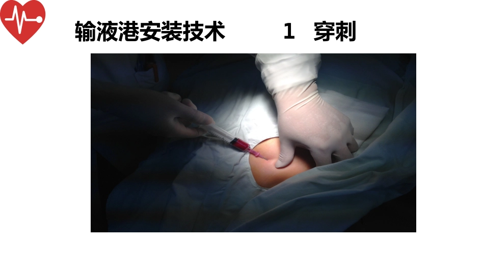 输液港的植入技术与维护_第14页