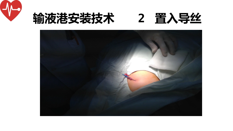 输液港的植入技术与维护_第15页