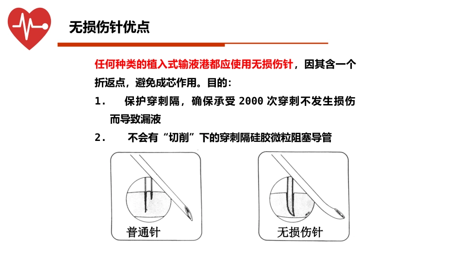 输液港的植入技术与维护_第8页