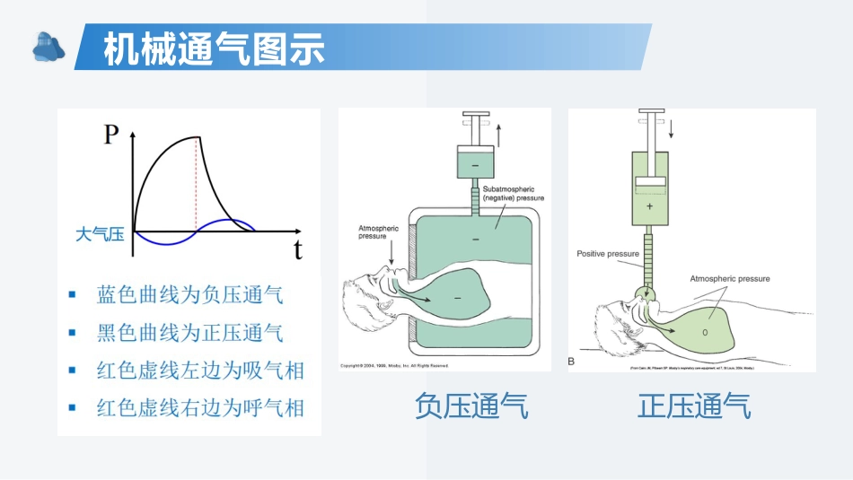 呼吸机的机械通气基本原理及基本模式_第13页