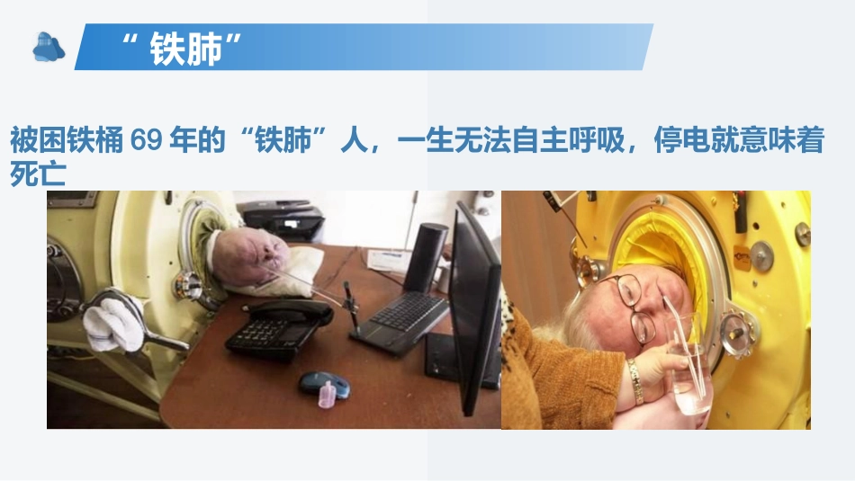 呼吸机的机械通气基本原理及基本模式_第9页