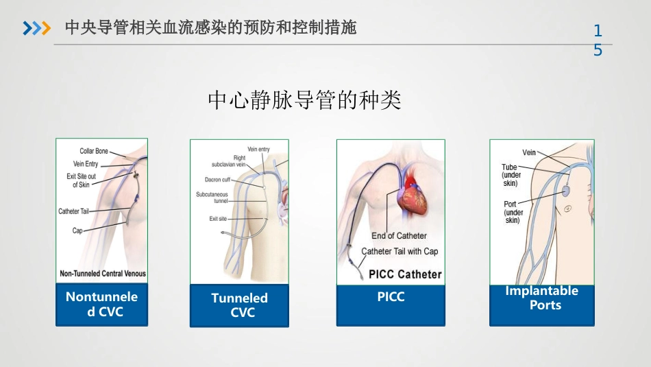 重症患者的医院感染预防与控制-感控培训课件_第15页