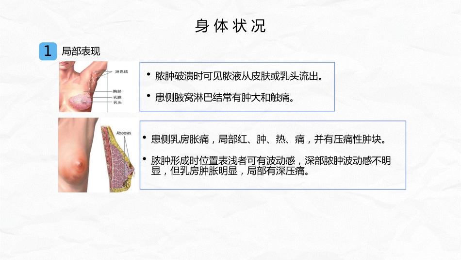 急性乳腺炎护理_第13页