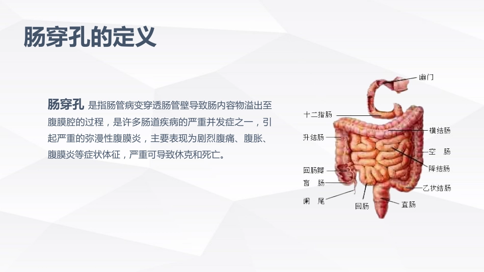 肠穿孔的护理学习_第4页