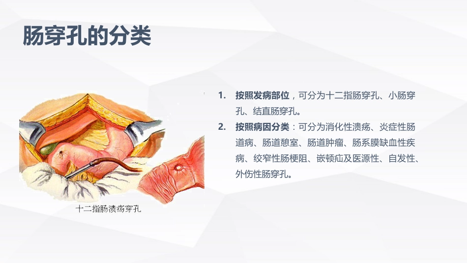 肠穿孔的护理学习_第5页