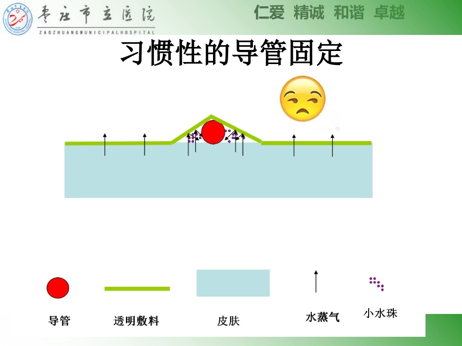 ICU常见管道固定安全管理_第12页