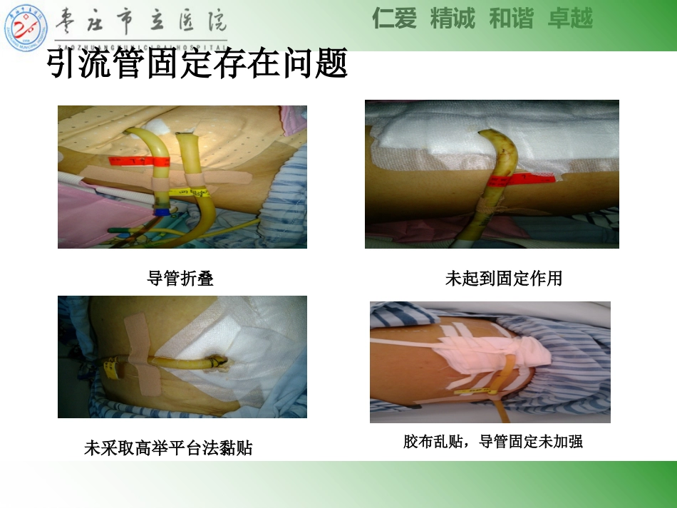ICU常见管道固定安全管理_第5页