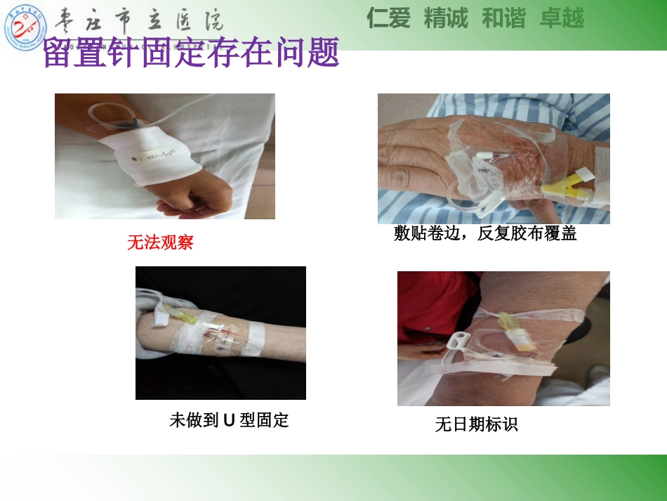 ICU常见管道固定安全管理_第6页