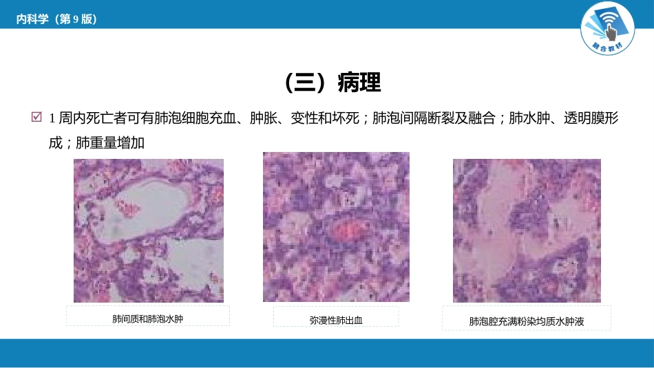 急诊重症科：急性百草枯中毒_第10页