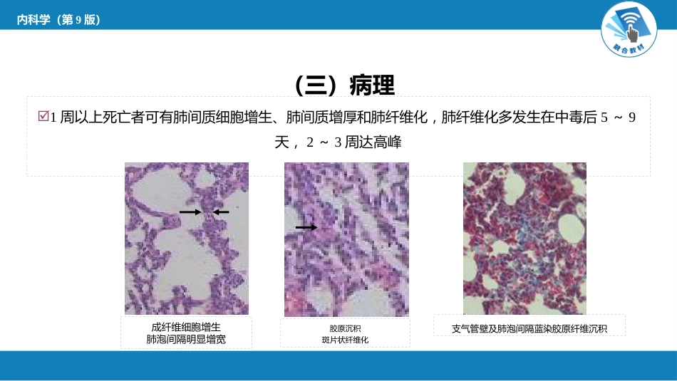急诊重症科：急性百草枯中毒_第11页
