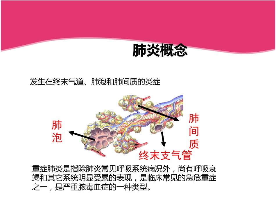 ICU重症肺炎护理查房_第8页