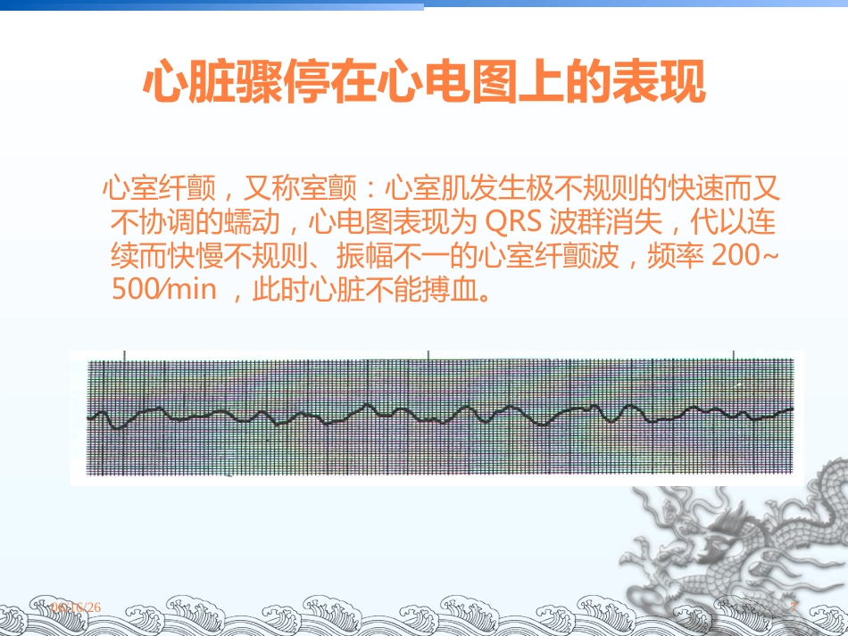 CPR护理查房课件_第7页