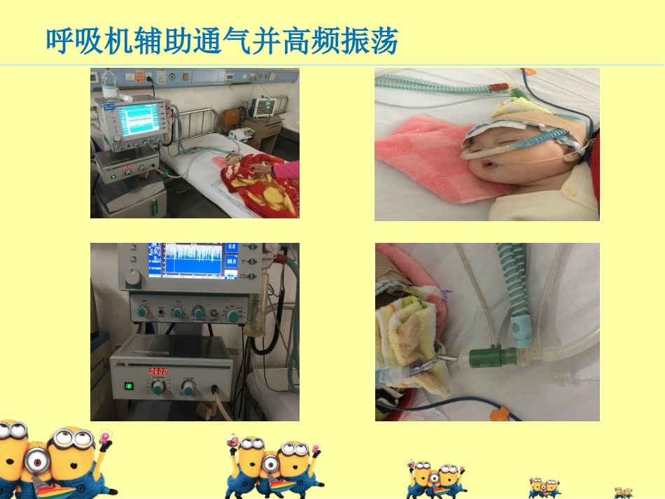ICU-小儿危重症护理查房_第15页