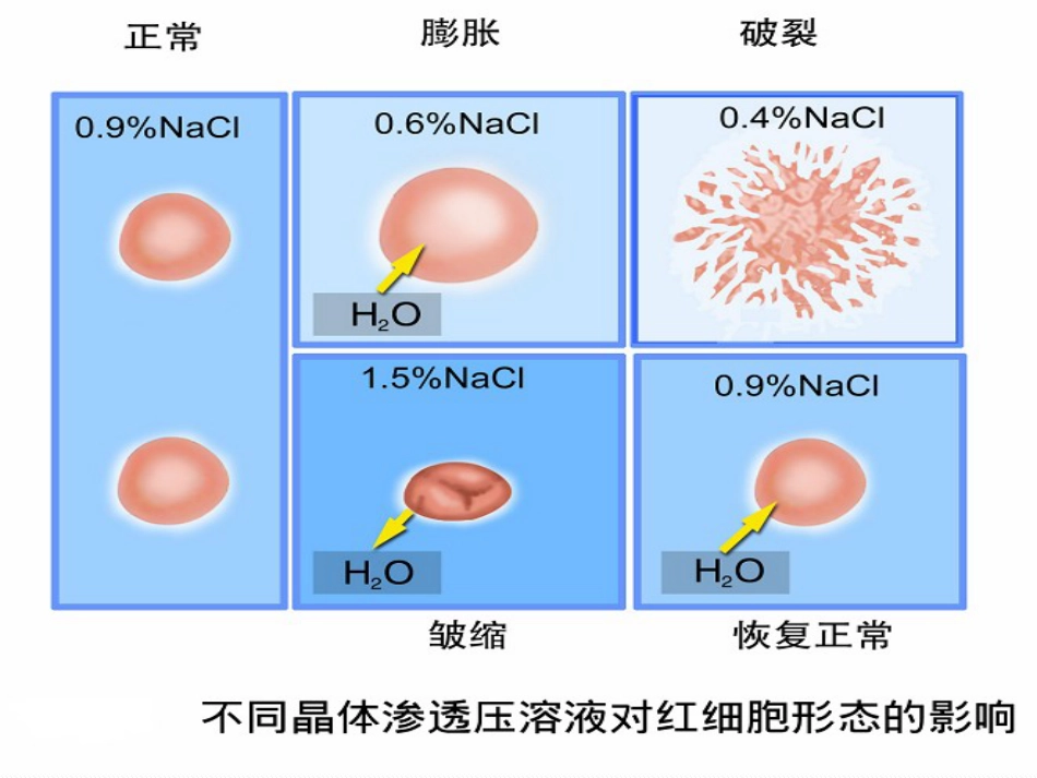 01.低渗性脱水_第7页