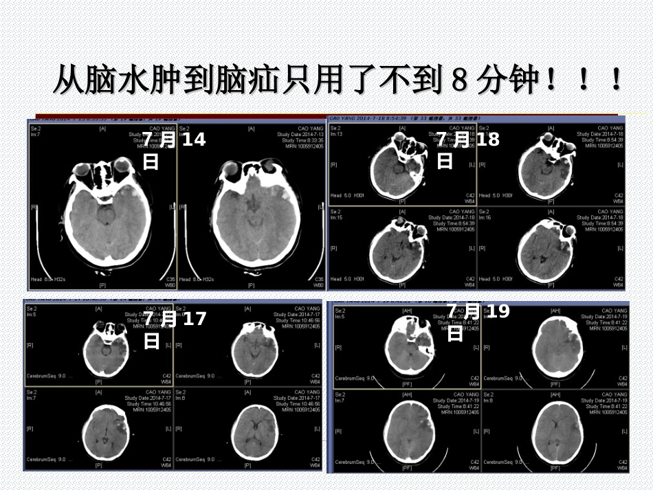 05.多发伤的特点与救治原则_第11页