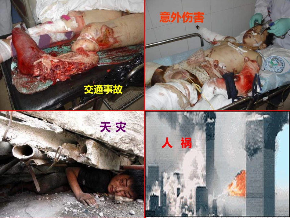 05.多发伤的特点与救治原则_第3页