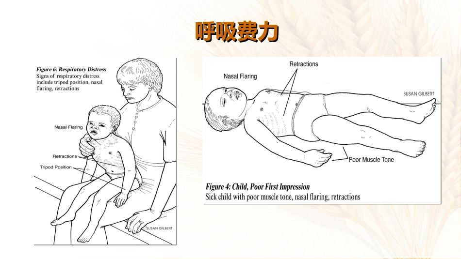 07.儿科呼吸系统急症应急处理流程_第13页