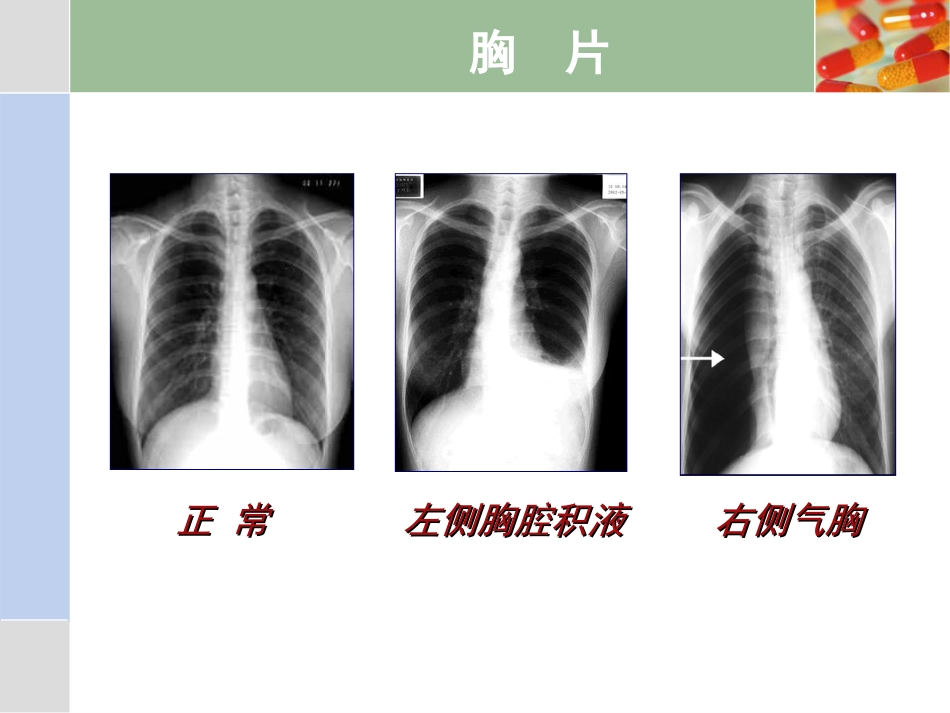 22.急性呼吸困难p_第7页