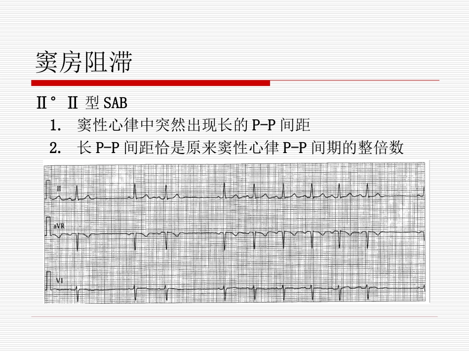 27.急诊班心律失常_第12页