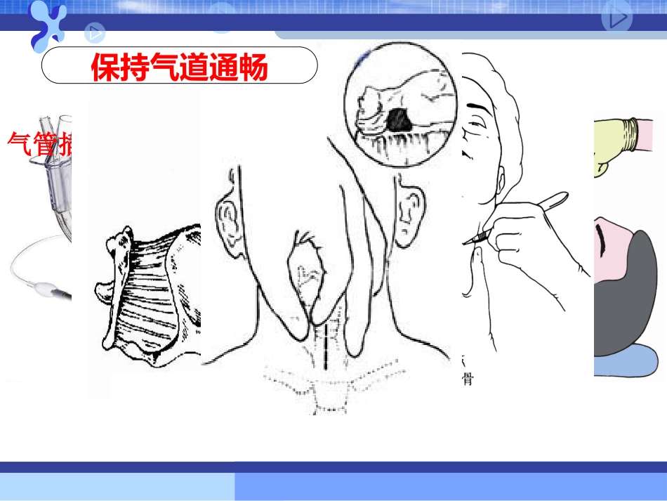 31.破伤风的临床分级及治疗_第14页