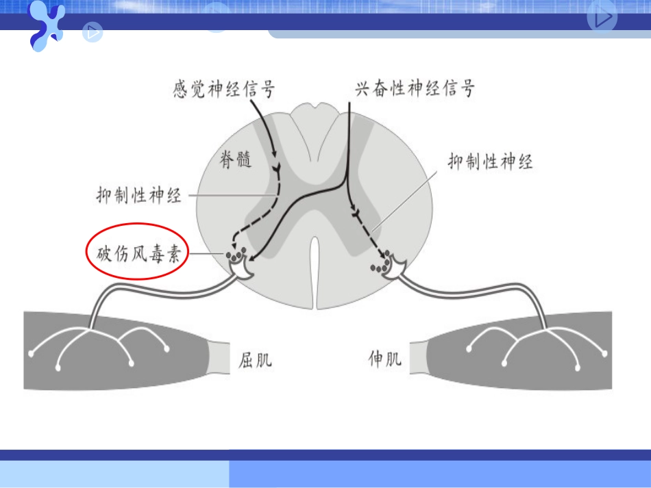 31.破伤风的临床分级及治疗_第2页