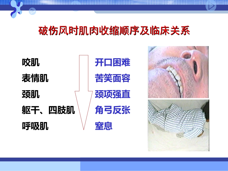 31.破伤风的临床分级及治疗_第4页