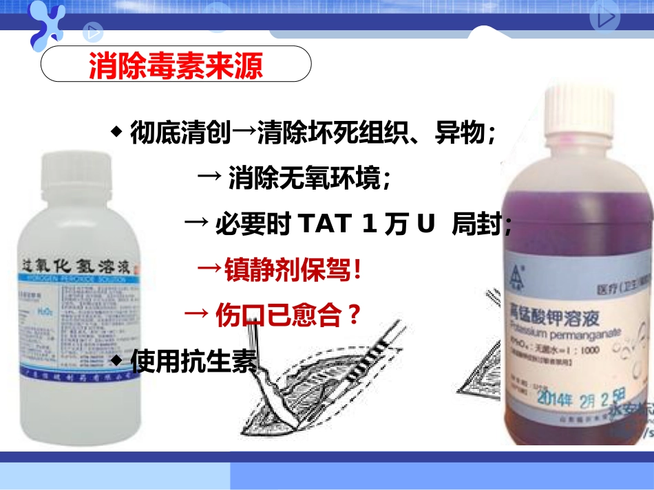 32.破伤风的治疗措施_第3页