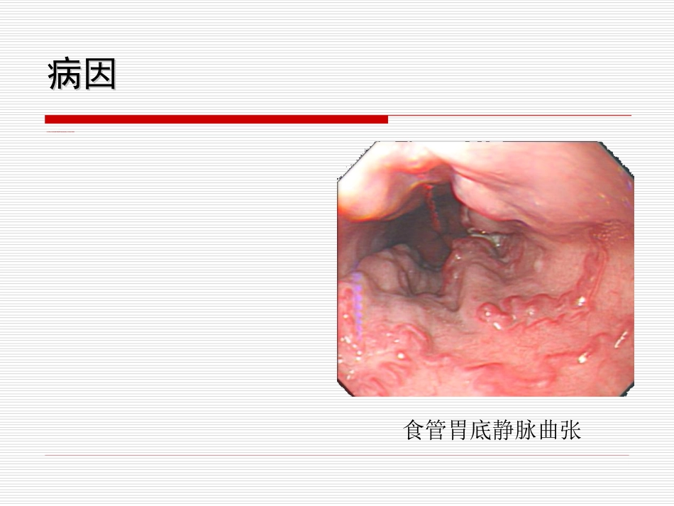 34.上消化道大出血_第14页