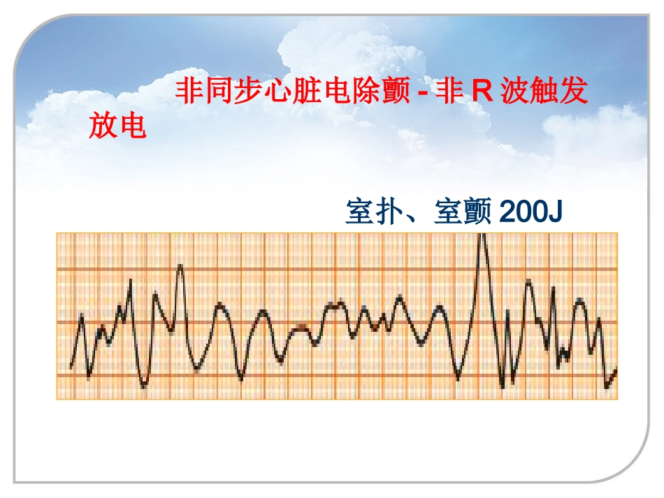 37.除颤和气管插管_第7页