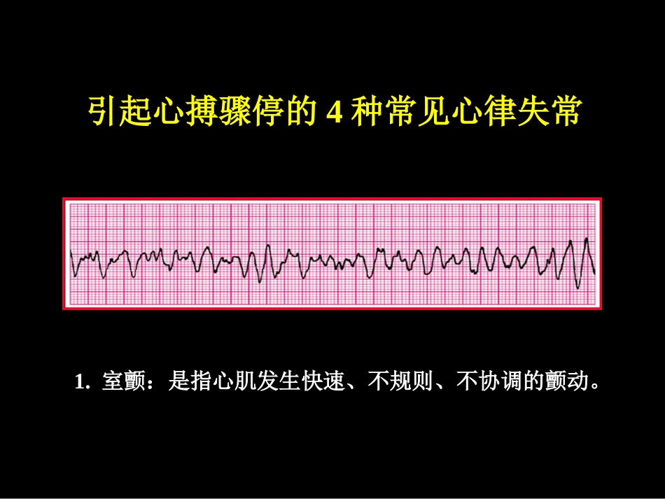 46.心肺脑复苏_第4页