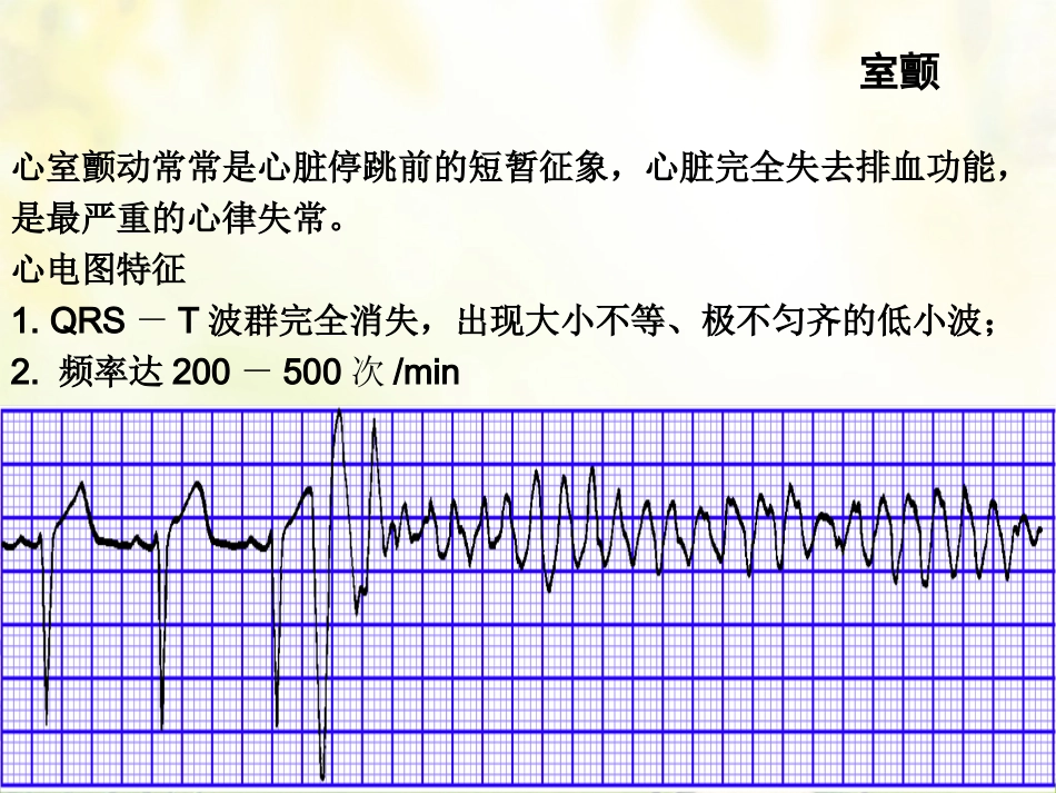 47.心脏电除颤_第12页