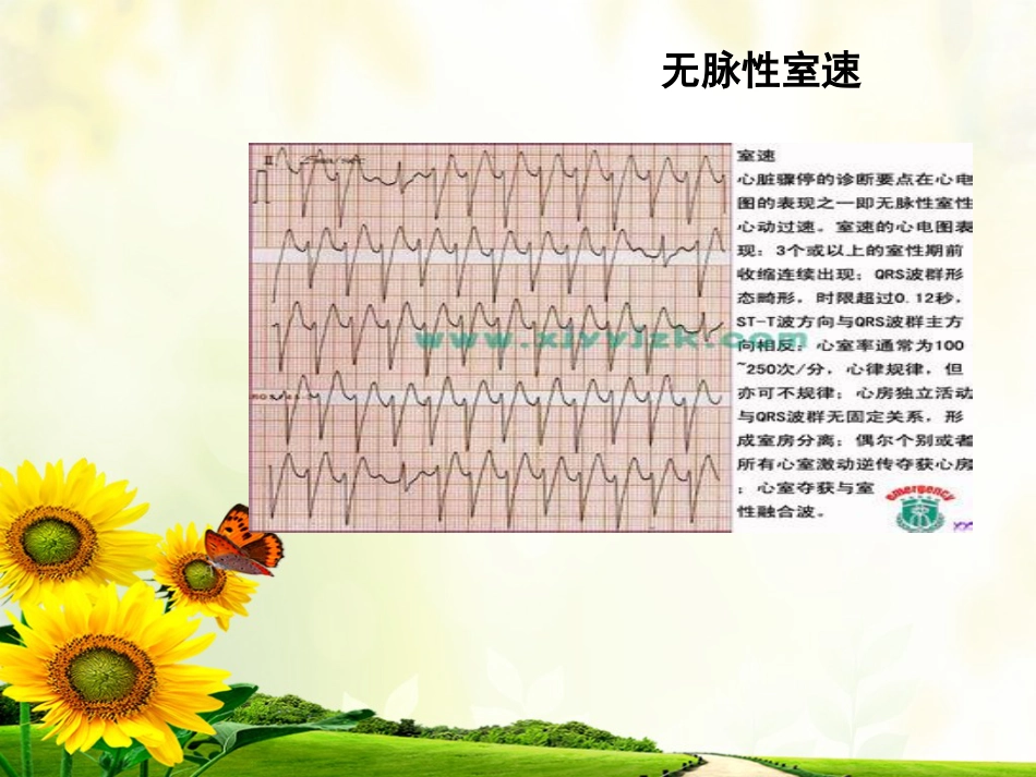 47.心脏电除颤_第13页