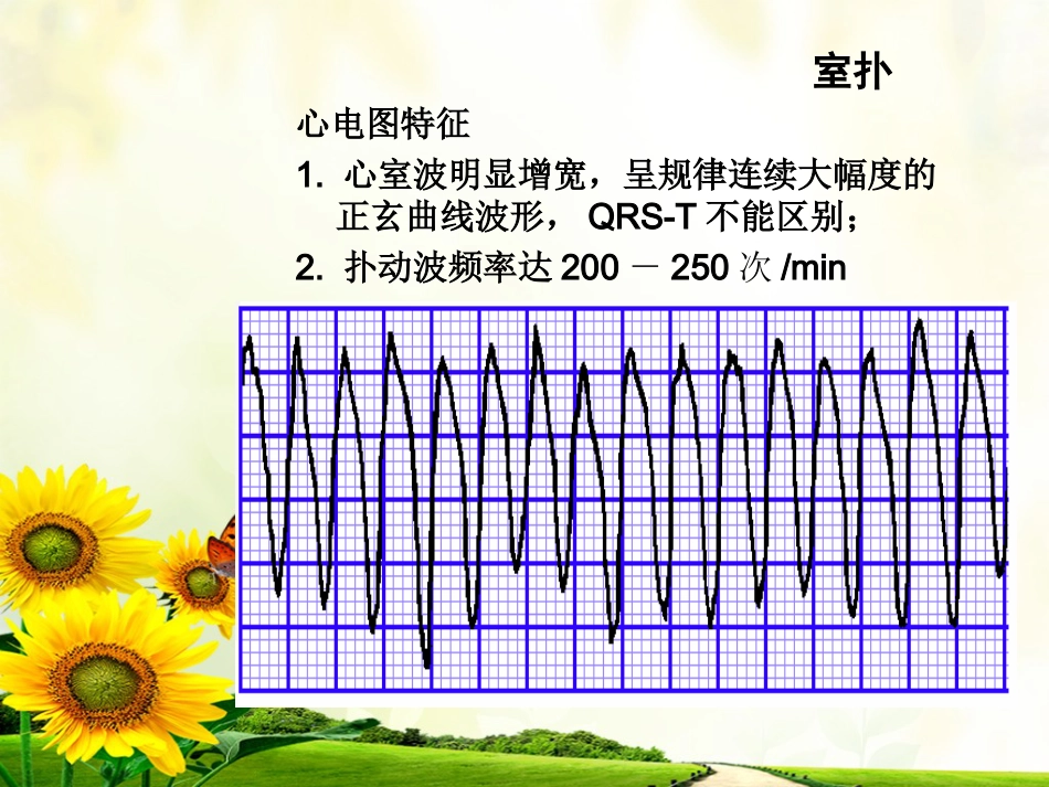 47.心脏电除颤_第14页