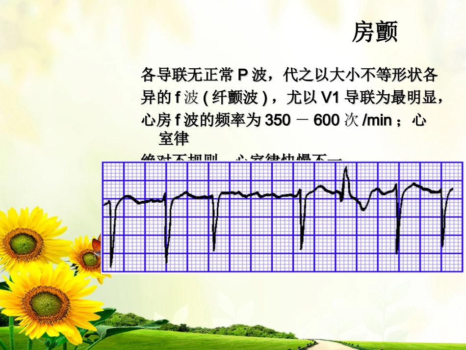 47.心脏电除颤_第15页