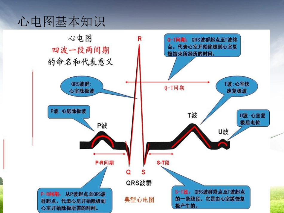 61.致命性心律失常曹又静_第3页