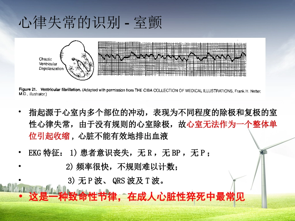61.致命性心律失常曹又静_第9页