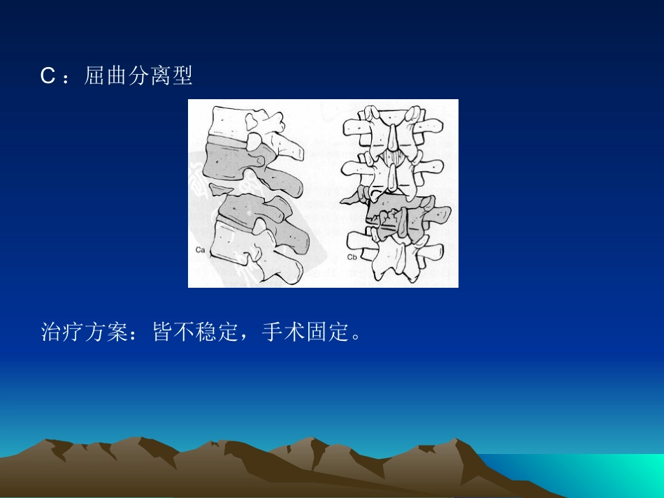 外科学：脊柱骨折常用分型及治疗原则_第12页