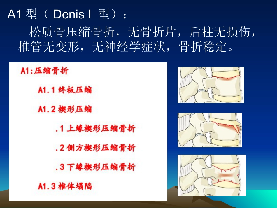 外科学：脊柱骨折常用分型及治疗原则_第14页