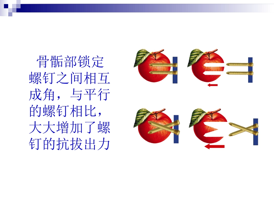 外科学：锁定钢板的应用及注意事项_第11页