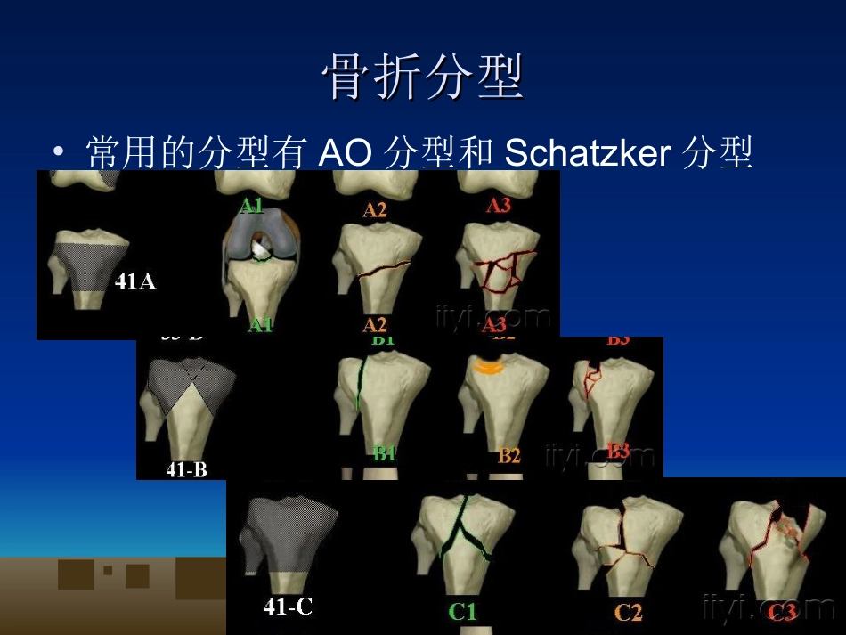 外科学：胫骨平台骨折的诊断及治疗_第5页