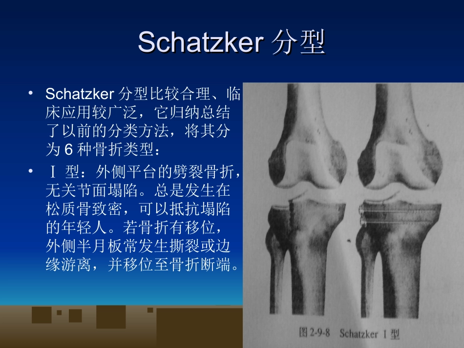 外科学：胫骨平台骨折的诊断及治疗_第7页