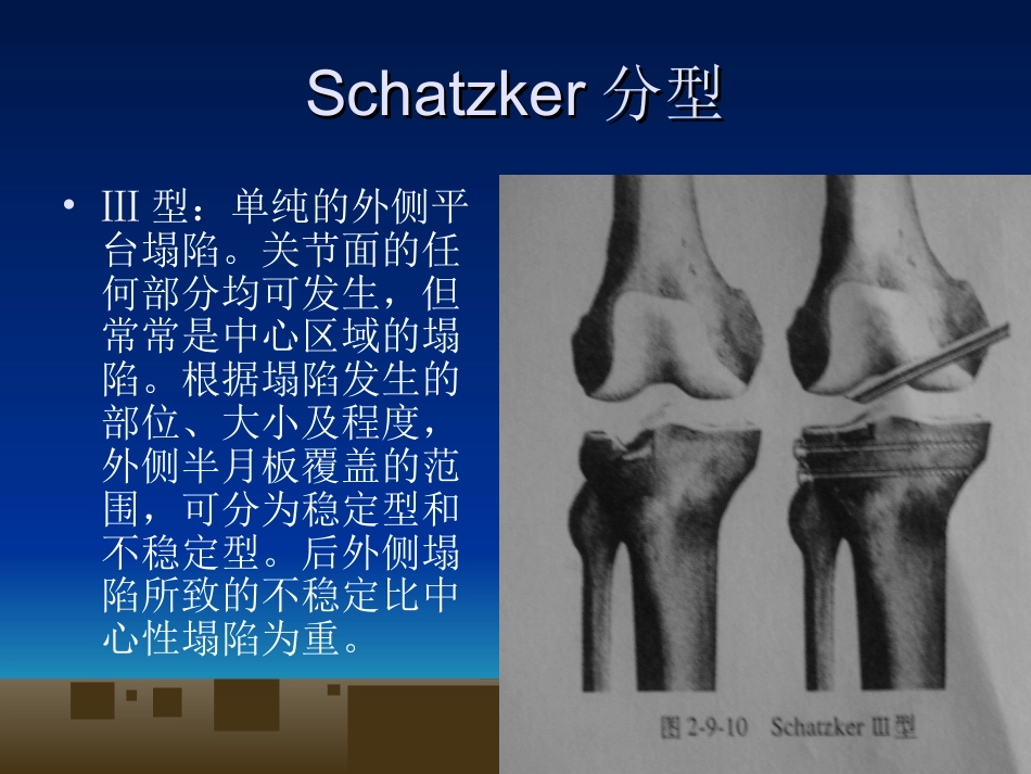 外科学：胫骨平台骨折的诊断及治疗_第9页