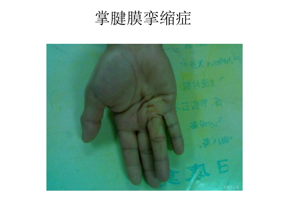 外科学：骨科特殊体征_第11页