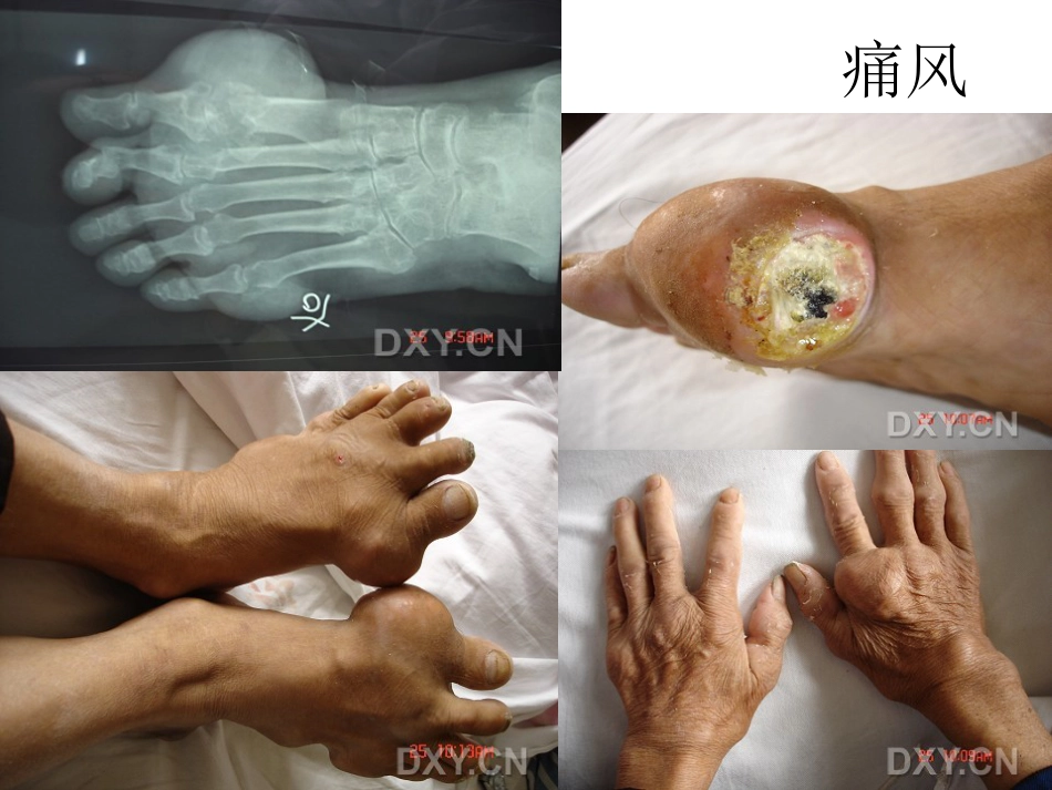 外科学：骨科特殊体征_第12页