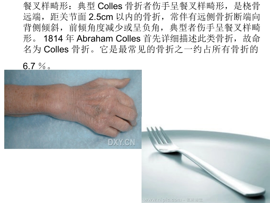 外科学：骨科特殊体征_第3页