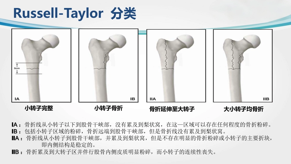 外科学：转子间骨折(2)_第10页