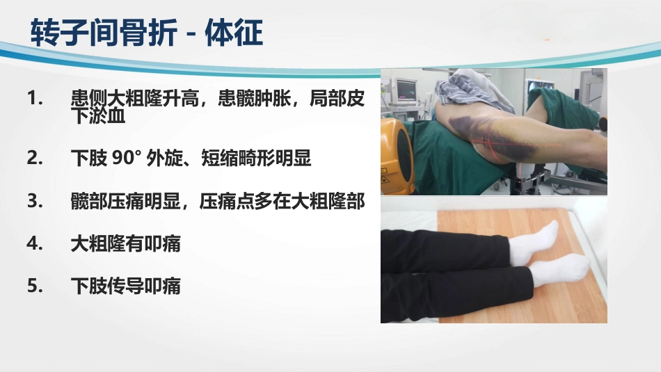 外科学：转子间骨折(2)_第12页