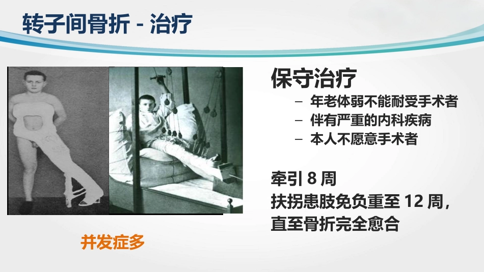 外科学：转子间骨折(2)_第14页