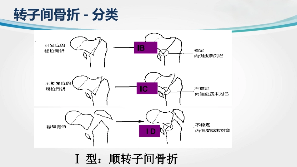 外科学：转子间骨折(2)_第6页